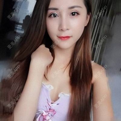 更美 - Imiss you的宽下巴矫正经验 | 玻尿酸下巴 | 下巴截骨前移 | 硅胶垫下巴 | 膨体垫下巴 | 宽下巴矫正 | 自体脂肪丰太阳穴 | 硅胶丰太阳穴 | 膨体丰太阳穴 | 人工骨垫下巴 | 成都
