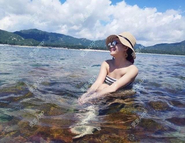 更美 - Imiss you的宽下巴矫正经验 | 下巴截骨前移 | 自体脂肪垫下巴 | 硅胶垫下巴 | 膨体垫下巴 | 玻尿酸下巴 | 宽下巴矫正 | 自体脂肪丰太阳穴 | 硅胶丰太阳穴 | 膨体丰太阳穴 | 人工骨垫下巴 | 成都