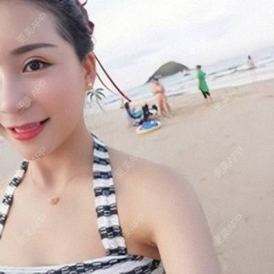 更美 - Imiss you的宽下巴矫正经验 | 下巴截骨前移 | 自体脂肪垫下巴 | 硅胶垫下巴 | 膨体垫下巴 | 玻尿酸下巴 | 宽下巴矫正 | 自体脂肪丰太阳穴 | 硅胶丰太阳穴 | 膨体丰太阳穴 | 人工骨垫下巴 | 成都