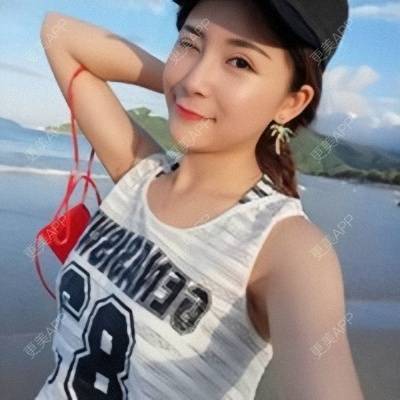 更美 - Imiss you的宽下巴矫正经验 | 下巴截骨前移 | 自体脂肪垫下巴 | 硅胶垫下巴 | 膨体垫下巴 | 玻尿酸下巴 | 宽下巴矫正 | 自体脂肪丰太阳穴 | 硅胶丰太阳穴 | 膨体丰太阳穴 | 人工骨垫下巴 | 成都