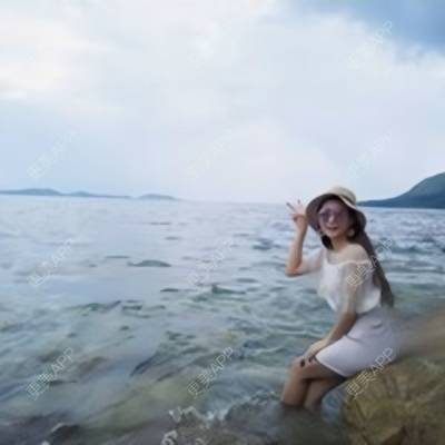 更美 - Imiss you的宽下巴矫正经验 | 下巴截骨前移 | 自体脂肪垫下巴 | 硅胶垫下巴 | 膨体垫下巴 | 玻尿酸下巴 | 宽下巴矫正 | 自体脂肪丰太阳穴 | 硅胶丰太阳穴 | 膨体丰太阳穴 | 人工骨垫下巴 | 成都