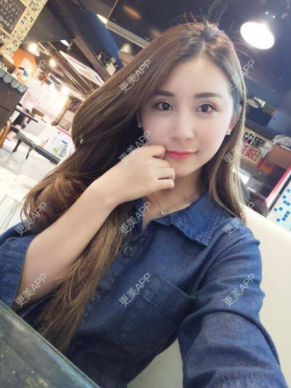 更美 - Imiss you的宽下巴矫正经验 | 膨体垫下巴 | 硅胶垫下巴 | 缩下巴 | 膨体丰太阳穴 | 人工骨垫下巴 | 玻尿酸下巴 | 下巴截骨前移 | 宽下巴矫正 | 自体脂肪丰太阳穴 | 硅胶丰太阳穴 | 成都