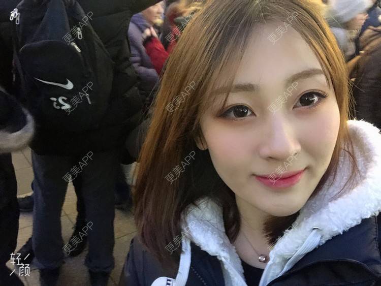 更美 - 梦离旧时光窝的激光淡化红血丝经验 | 北京 | 激光淡化红血丝