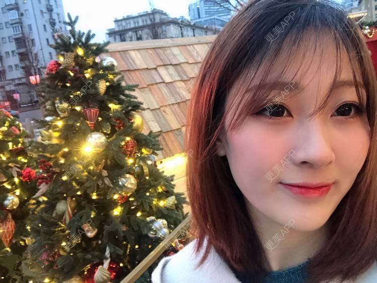 更美 - 梦离旧时光窝的激光淡化红血丝经验 | 北京 | 激光淡化红血丝