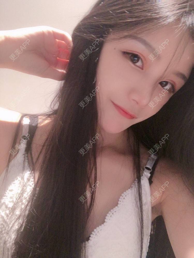 更美 - 更美用户OZmidMDOSa的鼻部多项经验 | 鼻部多项 | 郑州