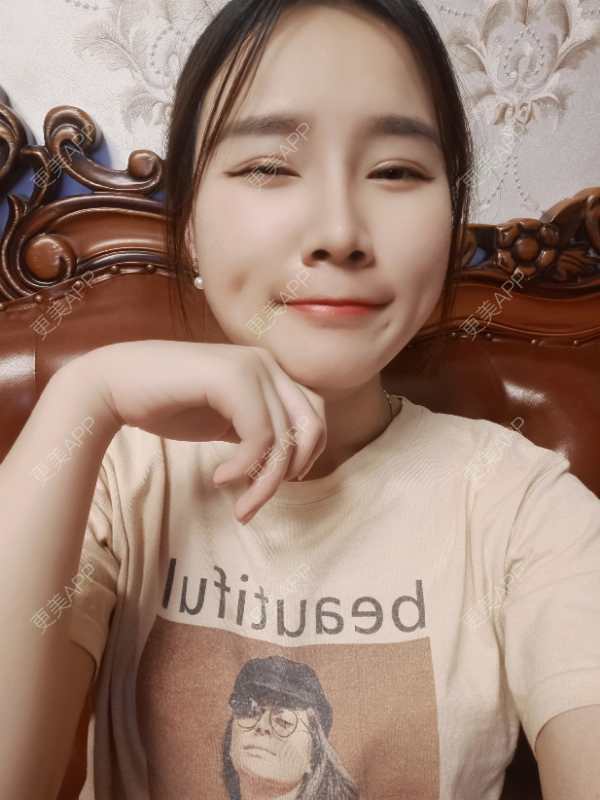更美 - 青苔上的蜗牛的吸脂瘦脸经验 | 吸脂瘦脸 | 重庆