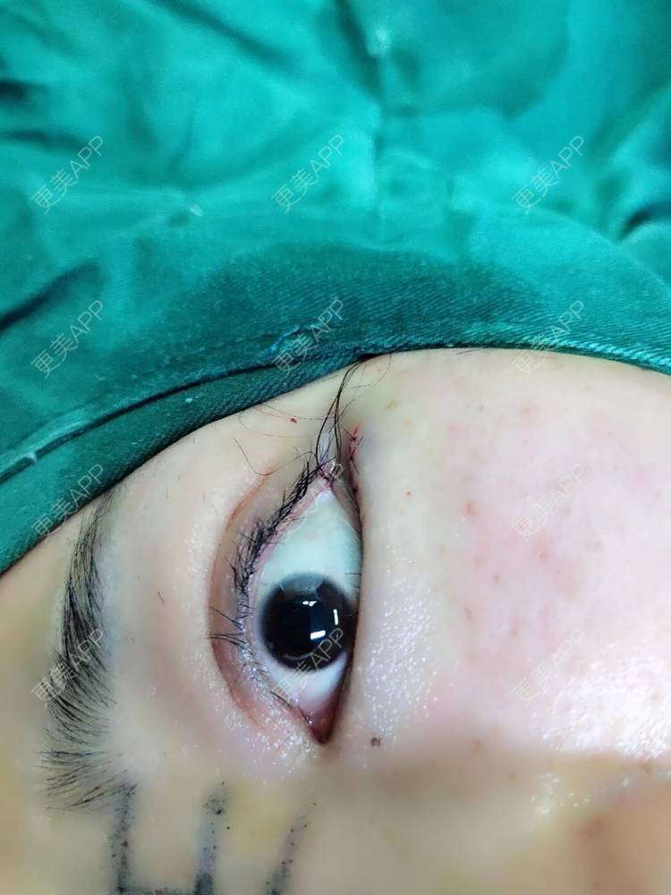 都是你的哦的开外眼角日记