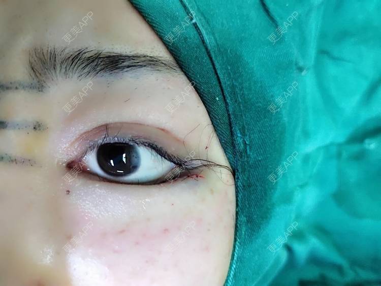 都是你的哦的开外眼角日记