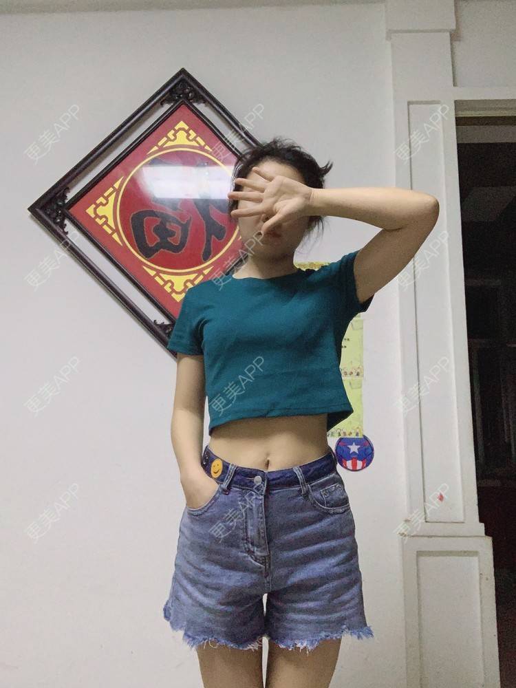 更美 - 更美用户UhNTrbf6Jt的吸脂塑臀经验 | 长沙 | 吸脂塑臀 | 热玛吉 | 超声提升