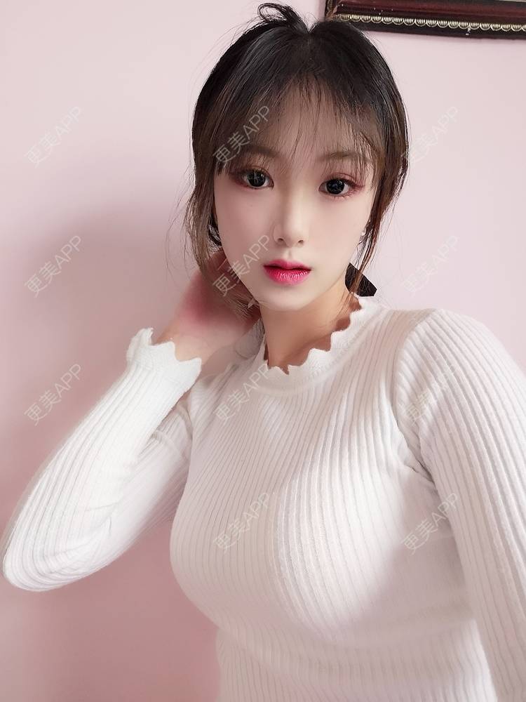 更美 - 更美用户tEAX7f1cKN的假体隆胸经验 | 广州 | 假体隆胸