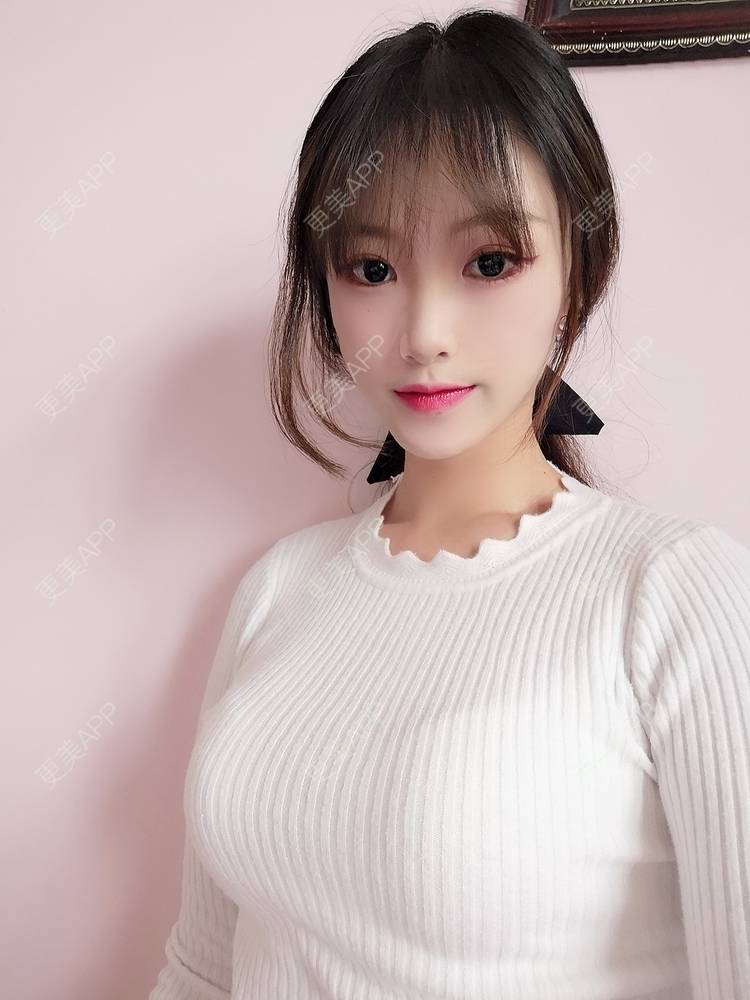 更美 - 更美用户tEAX7f1cKN的假体隆胸经验 | 广州 | 假体隆胸