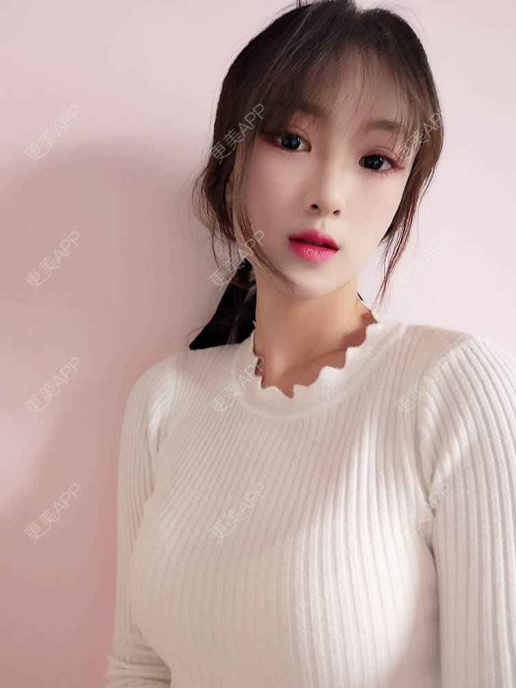更美 - 更美用户tEAX7f1cKN的假体隆胸经验 | 广州 | 假体隆胸