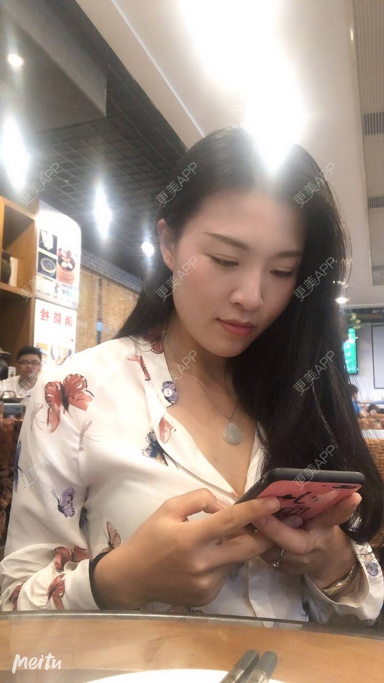 更美 - 更美用户M1Z1g3e73l的双下巴溶脂经验 | 双下巴溶脂