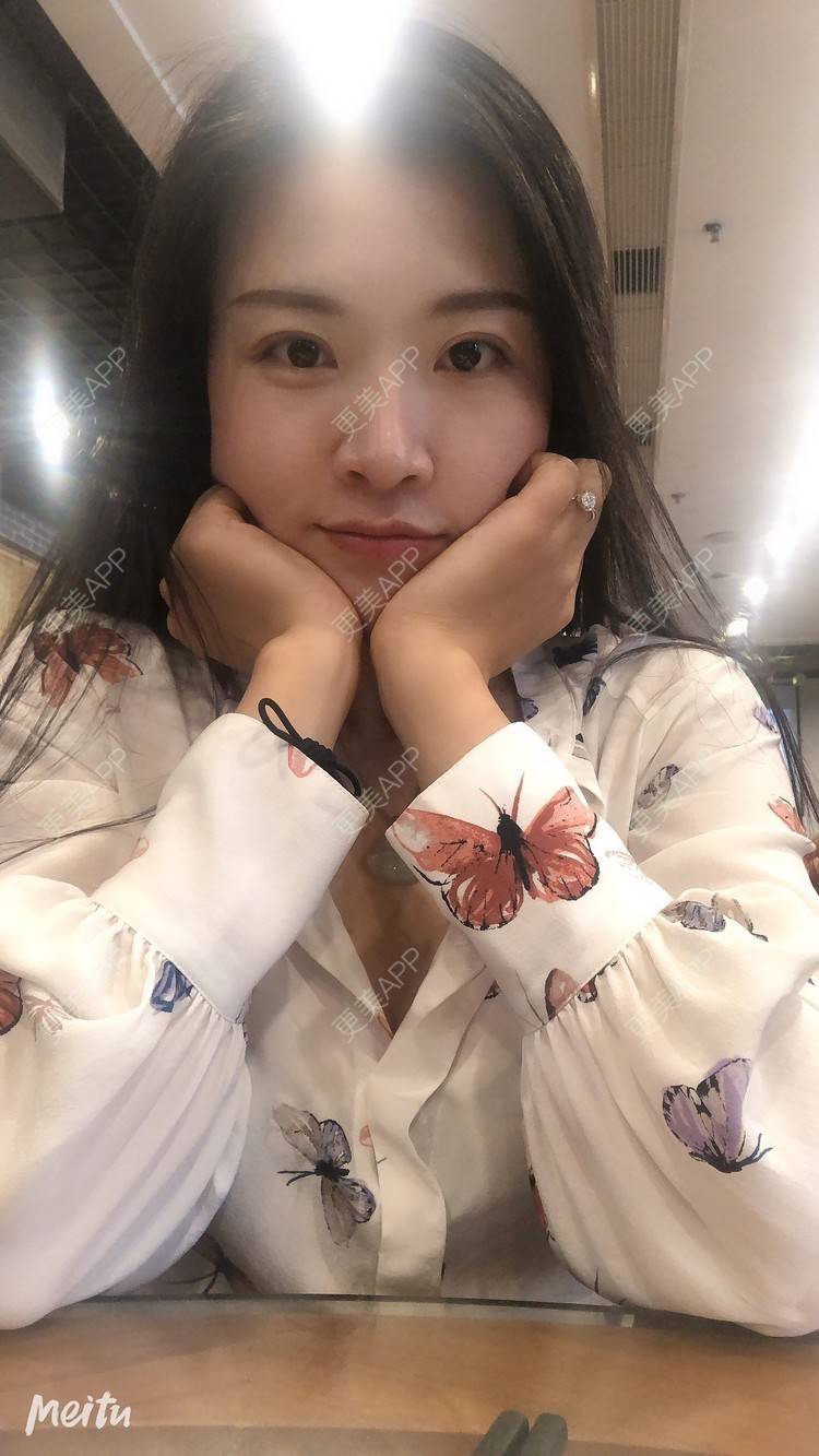 更美 - 更美用户M1Z1g3e73l的双下巴溶脂经验 | 双下巴溶脂