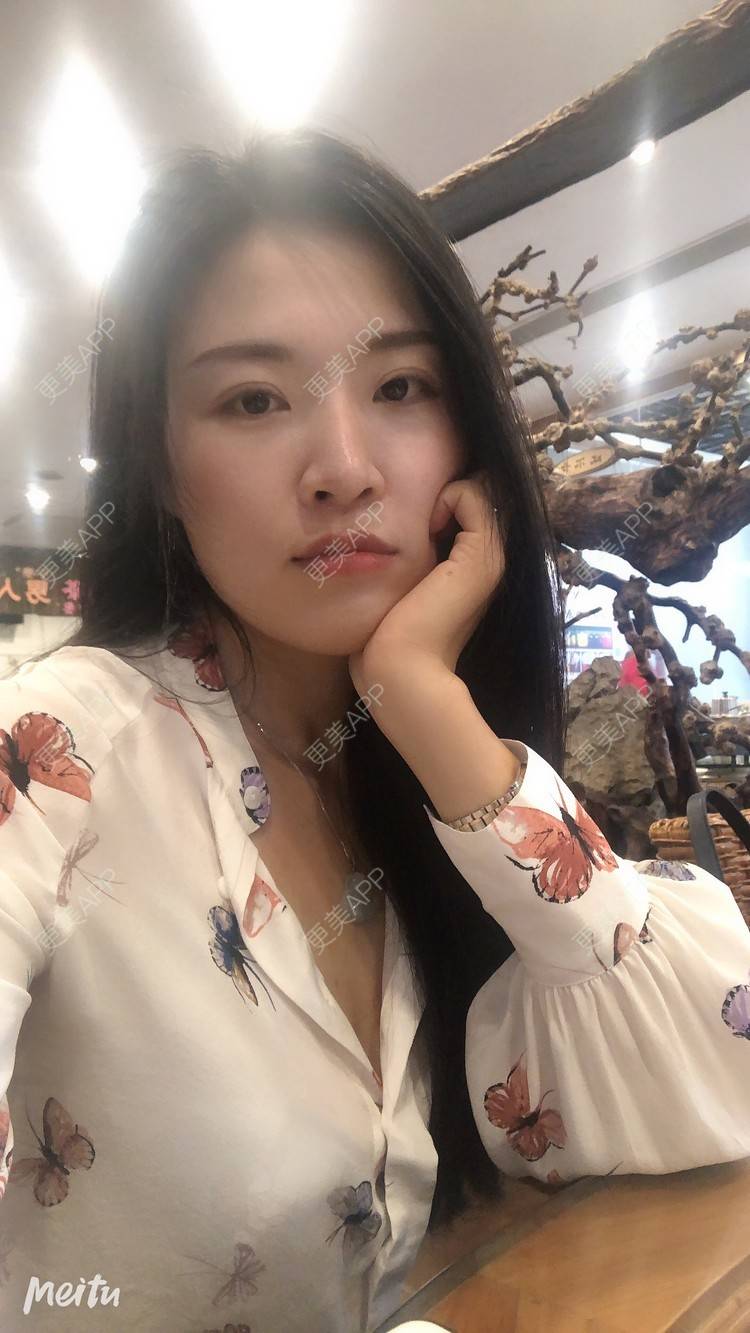 更美 - 更美用户M1Z1g3e73l的双下巴溶脂经验 | 双下巴溶脂