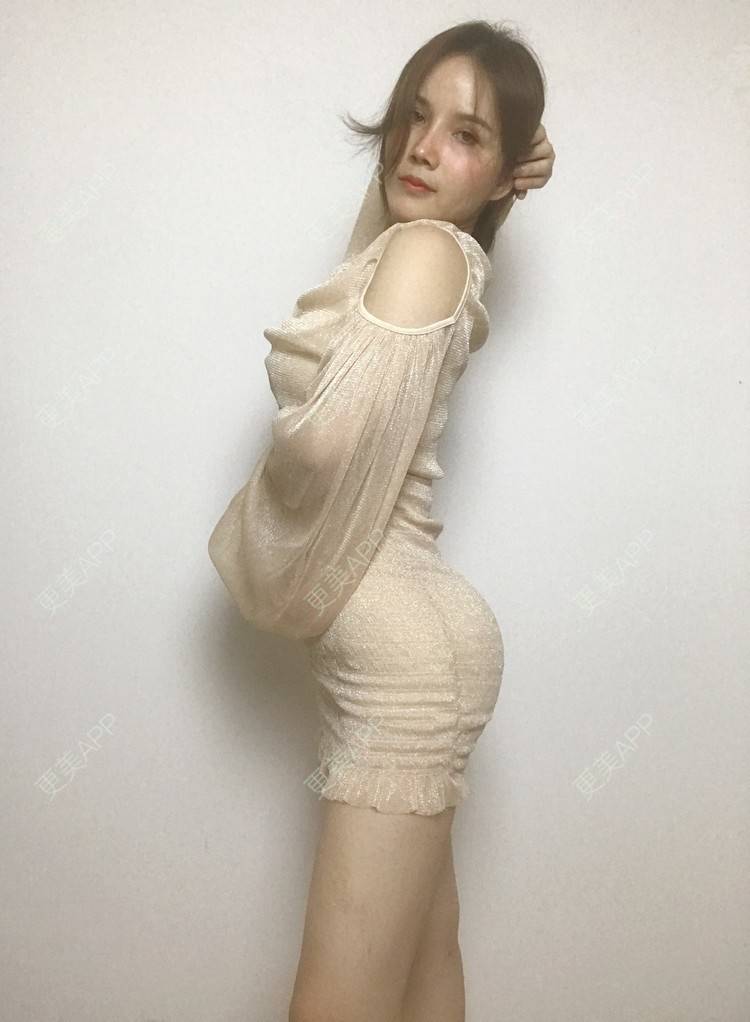 殷晓珺的假体丰臀日记