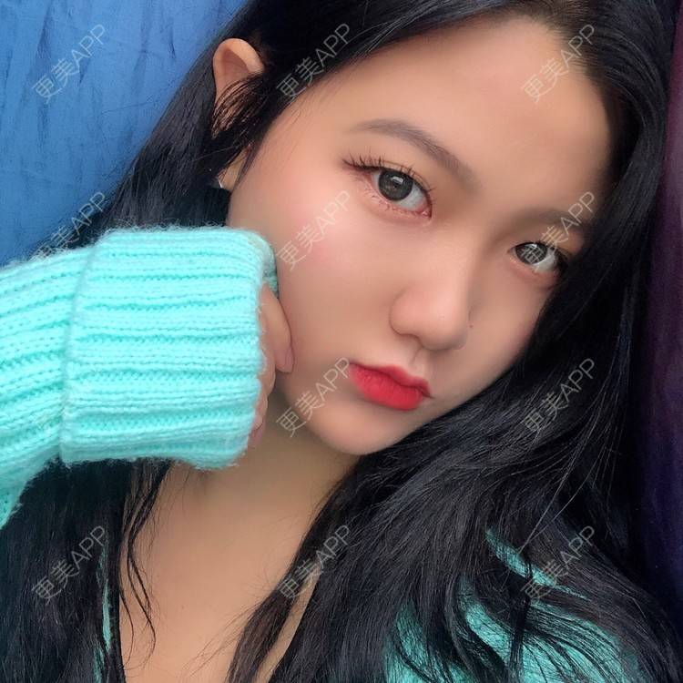 更美 - 男朋友是彭于晏的M唇成形经验 | M唇成形 | 杭州