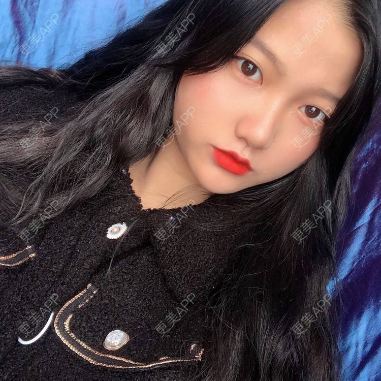 更美 - 男朋友是彭于晏的M唇成形经验 | M唇成形 | 杭州