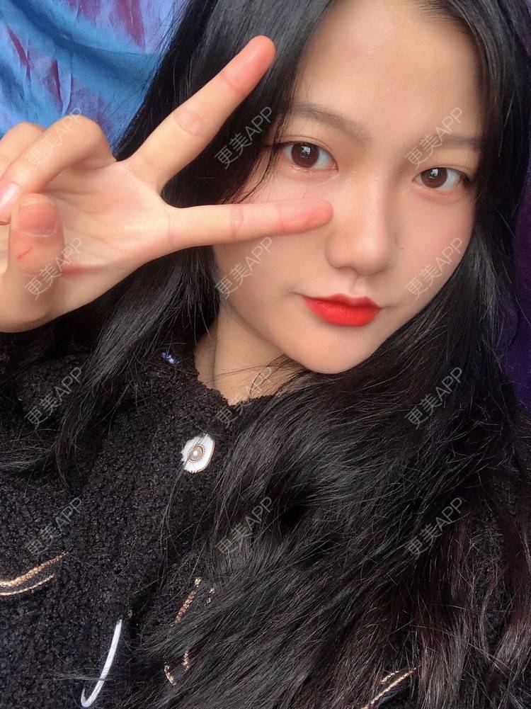 更美 - 男朋友是彭于晏的M唇成形经验 | M唇成形 | 杭州