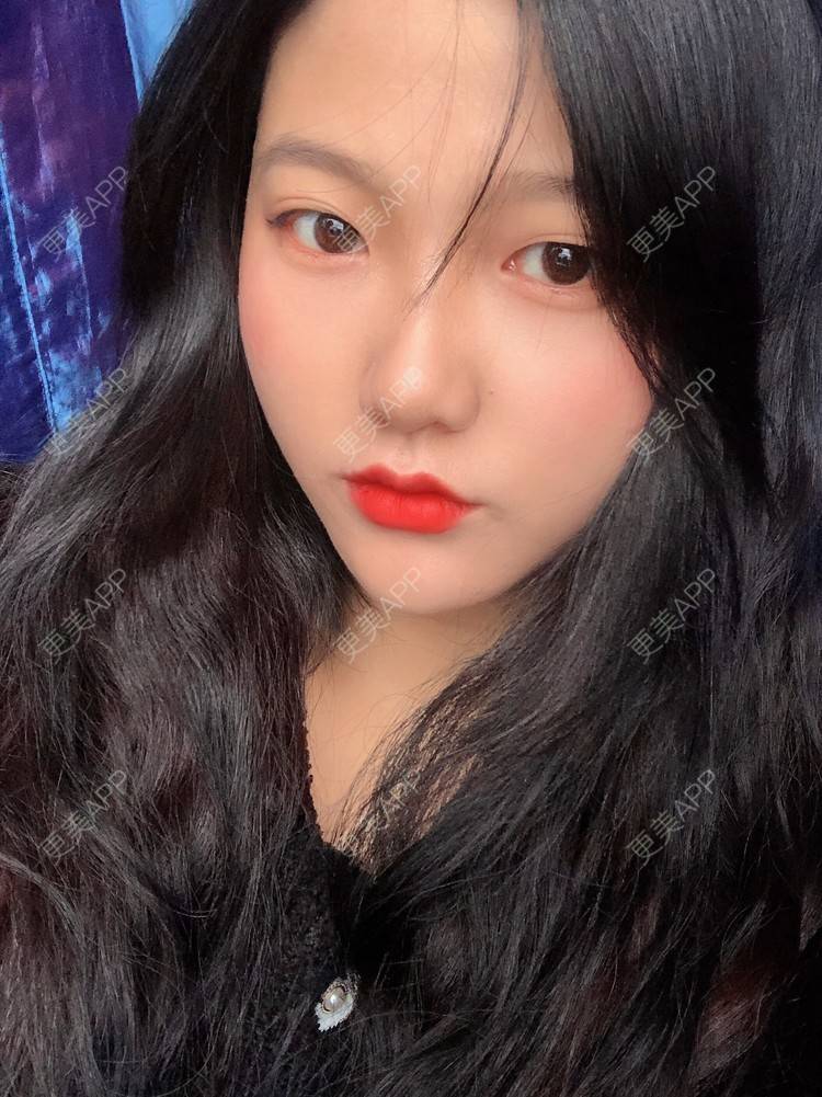 更美 - 男朋友是彭于晏的M唇成形经验 | M唇成形 | 杭州