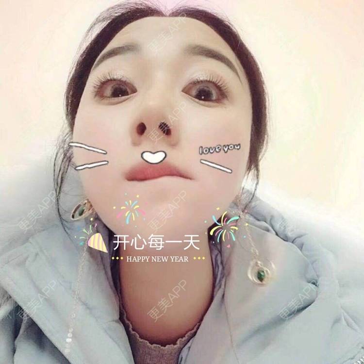 更美 - 阿玲铃的硅胶垫下巴经验 | 硅胶垫下巴 | 成都