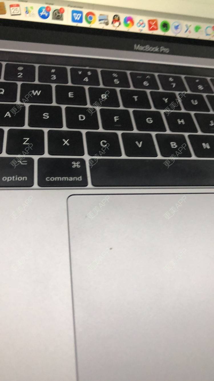 更美 - Mik皮卡丘的超声提升经验 | 超声提升 | 上海