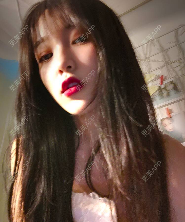 更美 - 更美用户F38SI0FUnA的埋线提升经验 | 埋线提升 | 东莞