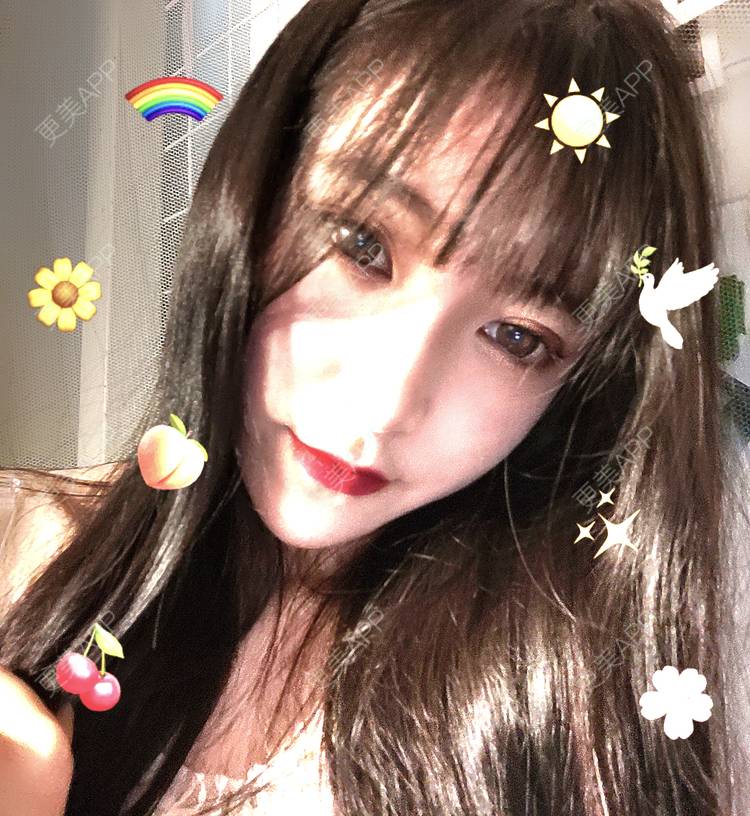 更美 - 更美用户F38SI0FUnA的埋线提升经验 | 埋线提升 | 东莞