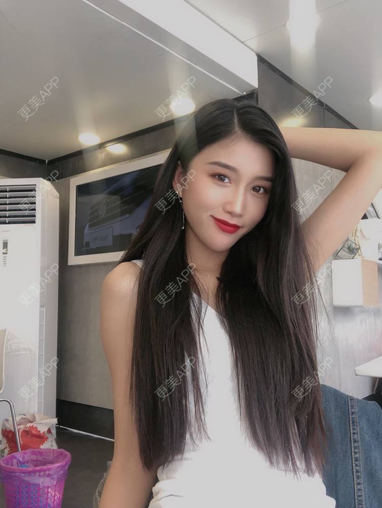 更美 - 木子木可的M唇成形经验 | M唇成形 | 杭州