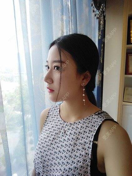 更美 - 阿玲铃的硅胶垫下巴经验 | 硅胶垫下巴 | 成都
