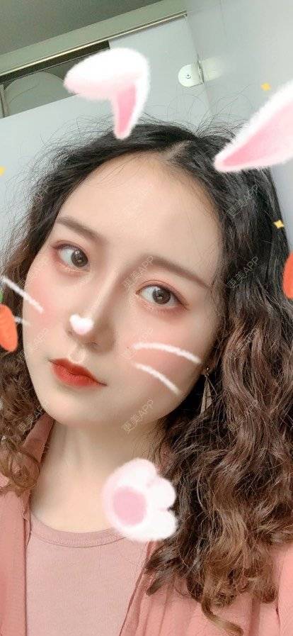 更美 - 圆方脸课代表ʚ😊ɞ的隆鼻经验 | 隆鼻 | 耳软骨隆鼻 | 假体垫鼻基底 | 鼻部多项 | 全切双眼皮 | 自体软骨垫鼻尖 | 硅胶隆鼻 | 南京 | 视频日记