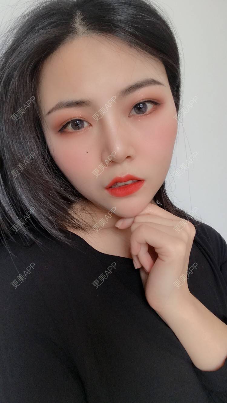 更美 - 虫栗的双眼皮经验 | 双眼皮 | 北京