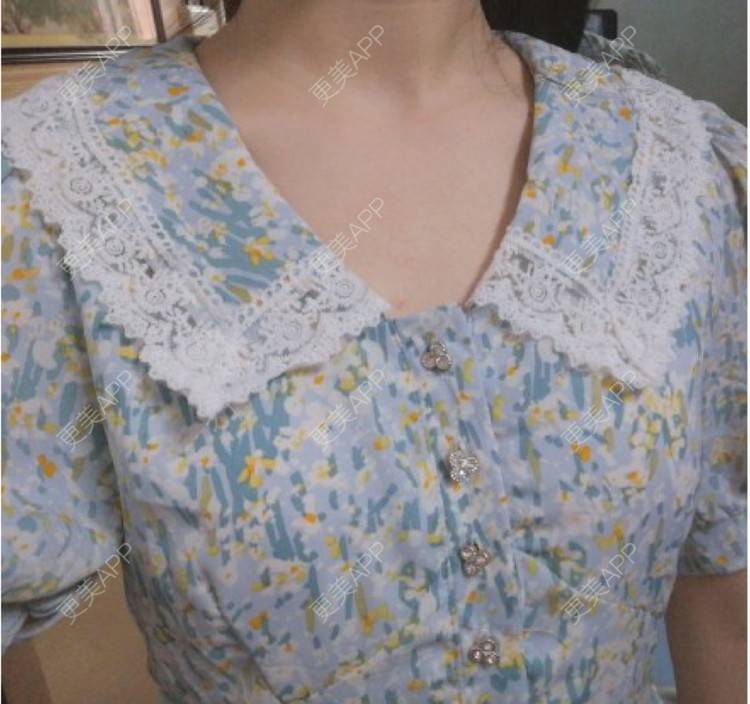 更美 - 更美用户q1IlawvR4y的乳晕缩小经验 | 乳晕缩小 | 深圳