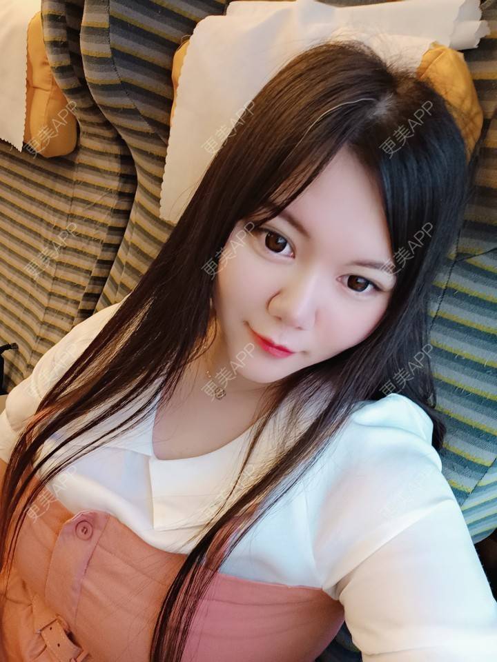 更美 - sonder.的下巴经验 | 下巴 | 硅胶垫下巴 | 长沙 | 视频日记