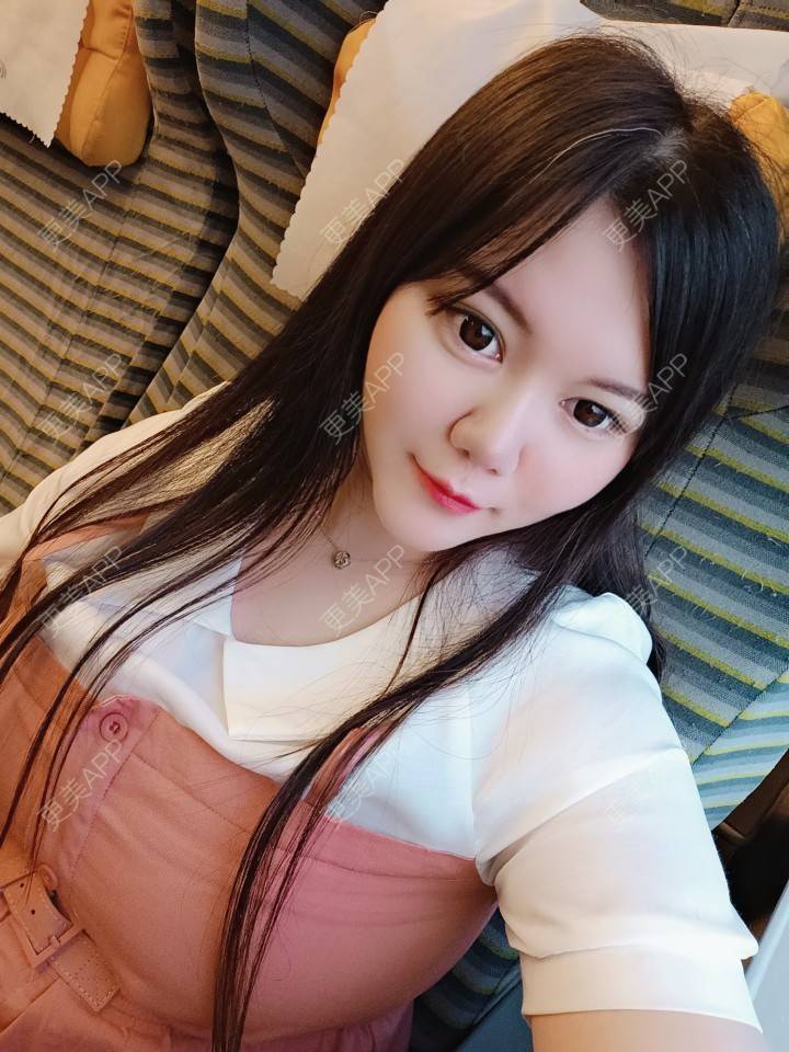 更美 - sonder.的下巴经验 | 下巴 | 硅胶垫下巴 | 长沙 | 视频日记