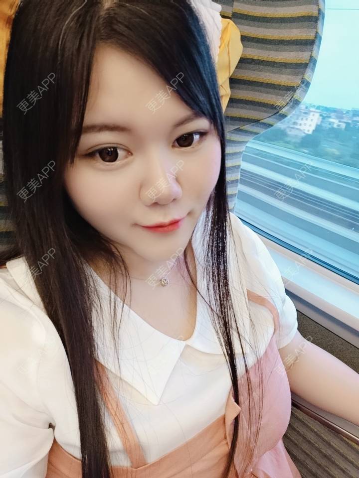 更美 - sonder.的下巴经验 | 下巴 | 硅胶垫下巴 | 长沙 | 视频日记