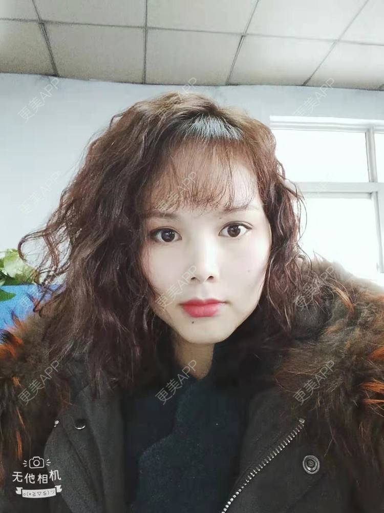 更美 - 更美用户VzYLHjPH4B的拉皮经验 | 郑州 | 拉皮