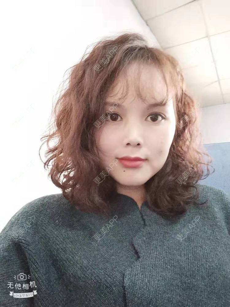 更美 - 更美用户VzYLHjPH4B的拉皮经验 | 郑州 | 拉皮