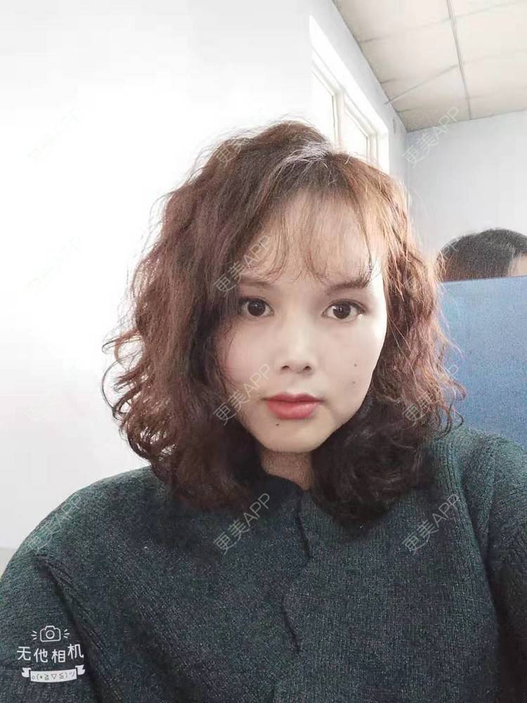 更美 - 更美用户VzYLHjPH4B的拉皮经验 | 郑州 | 拉皮