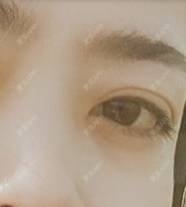 更美 - 更美用户jUaNUyzmkh的孕睫术经验 | 深圳 | 孕睫术