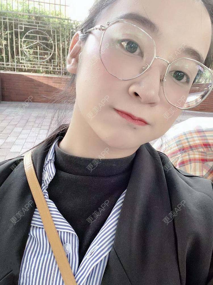 更美 - 更美用户129LF9Yh6a的玻尿酸下巴经验 | 广州 | 视频日记 | 玻尿酸下巴