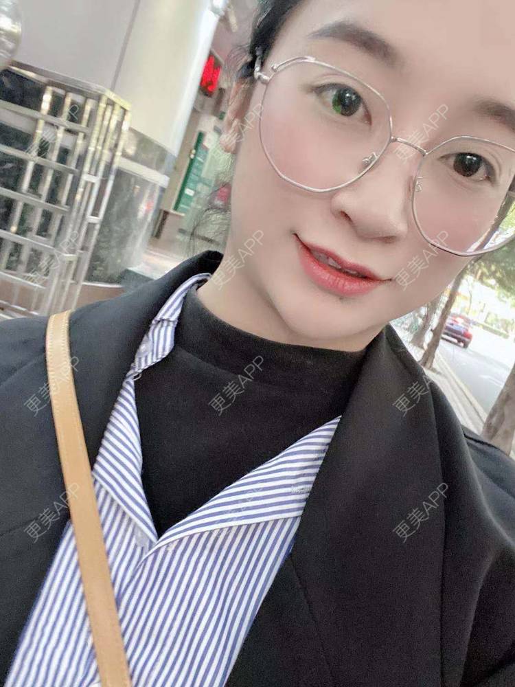 更美 - 更美用户129LF9Yh6a的玻尿酸下巴经验 | 广州 | 视频日记 | 玻尿酸下巴