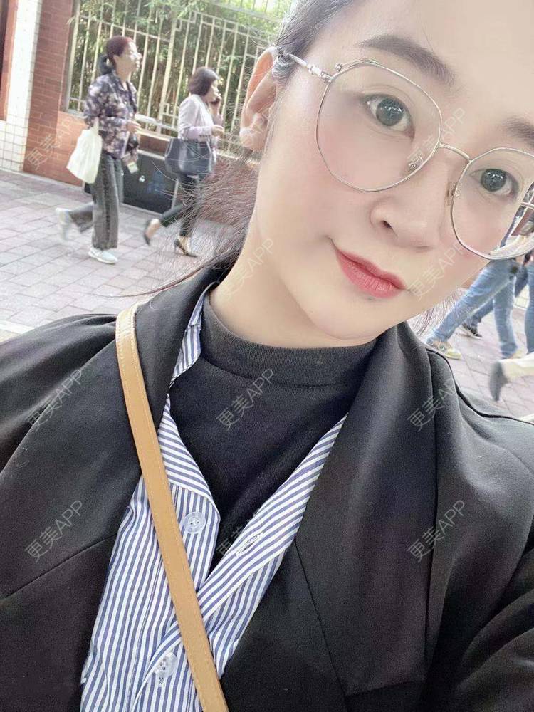 更美 - 更美用户129LF9Yh6a的玻尿酸下巴经验 | 广州 | 视频日记 | 玻尿酸下巴