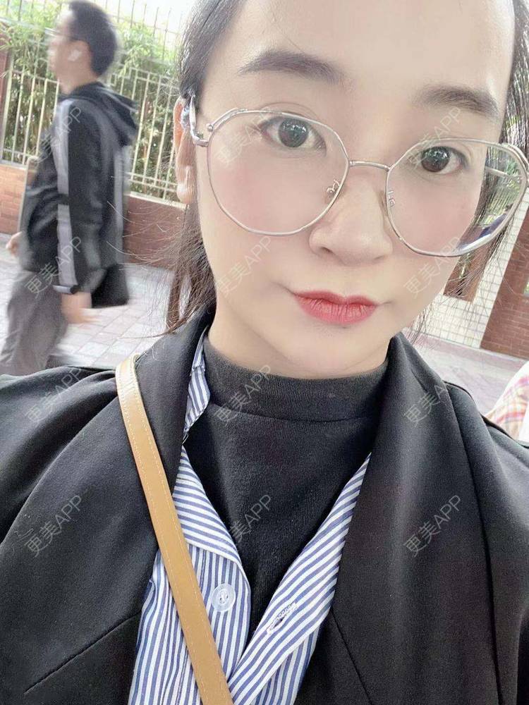 更美 - 更美用户129LF9Yh6a的玻尿酸下巴经验 | 广州 | 视频日记 | 玻尿酸下巴