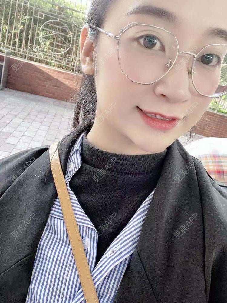 更美 - 更美用户129LF9Yh6a的玻尿酸下巴经验 | 广州 | 视频日记 | 玻尿酸下巴