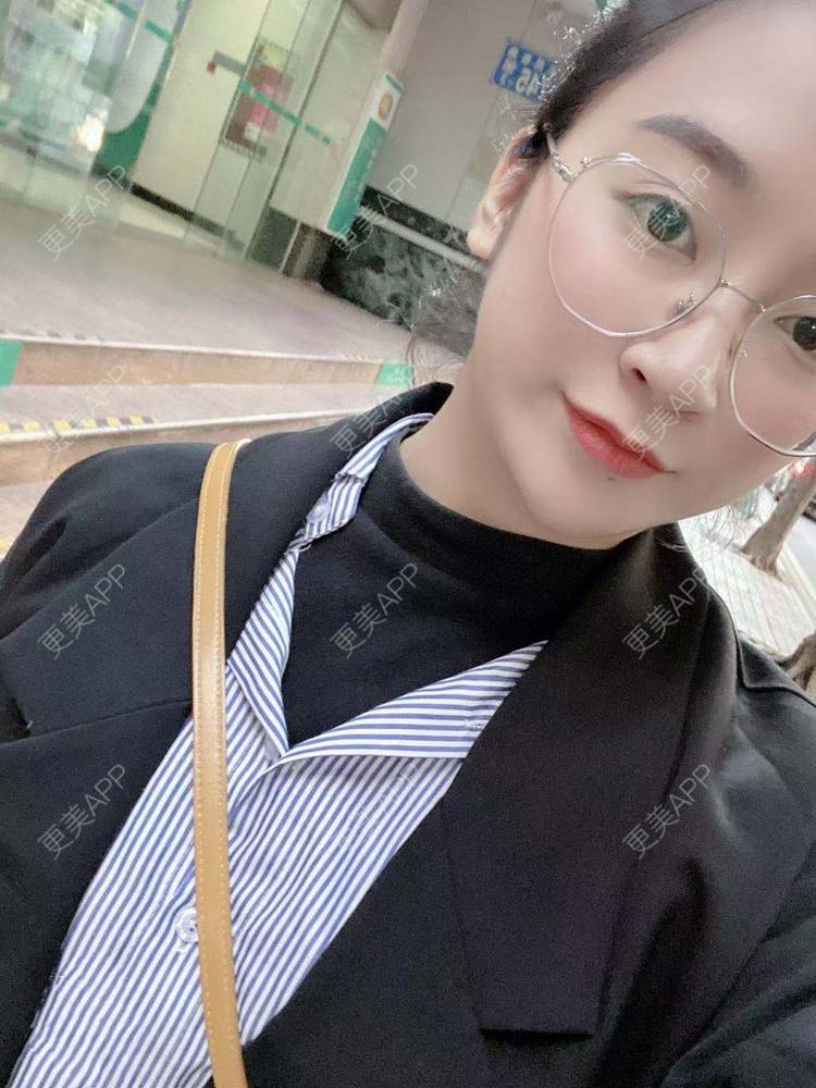 更美 - 更美用户129LF9Yh6a的玻尿酸下巴经验 | 广州 | 视频日记 | 玻尿酸下巴