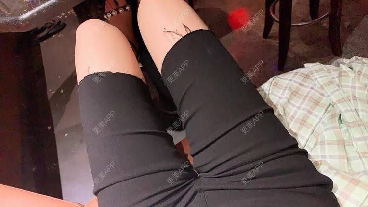 更美 - 请叫我小花的吸脂瘦大腿经验 | 吸脂瘦大腿 | 北京