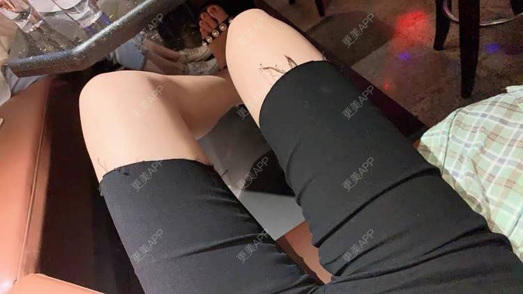 更美 - 请叫我小花的吸脂瘦大腿经验 | 吸脂瘦大腿 | 北京