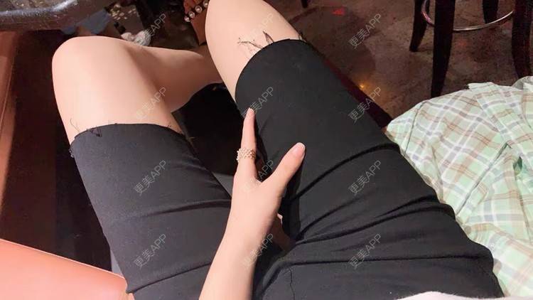 更美 - 请叫我小花的吸脂瘦大腿经验 | 吸脂瘦大腿 | 北京