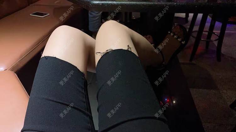 更美 - 请叫我小花的吸脂瘦大腿经验 | 吸脂瘦大腿 | 北京